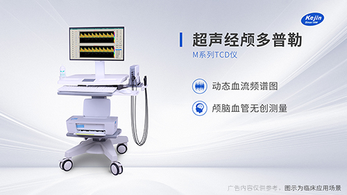 采購經(jīng)顱多普勒超聲找源頭廠家的方法